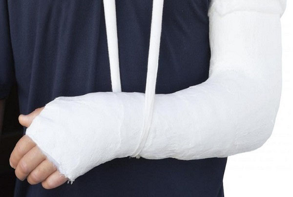 Fracture Treatment