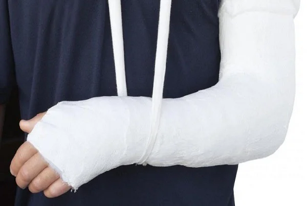 Fracture Treatment