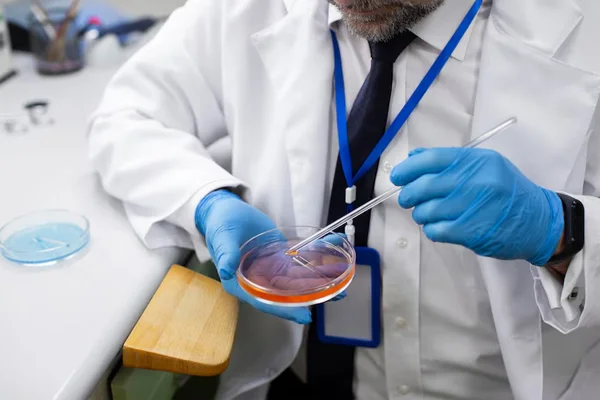 Autologus Cell Transplant